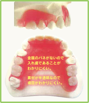 ・金属のバネがないので入れ歯であることがわかりにくい。 ・素材が半透明なので境目がわかりにくい。 